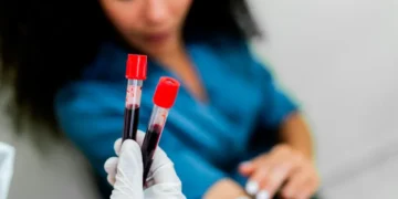 Exciting results from blood test for 50 cancers