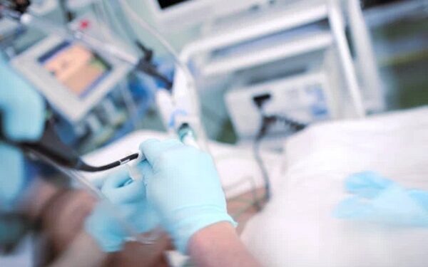 Doctor performing endoscopic procedure to the patient in the ICU.