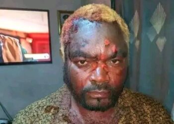 General Kanene hospitalised after machete attack at rally