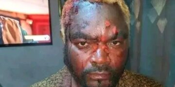 General Kanene hospitalised after machete attack at rally