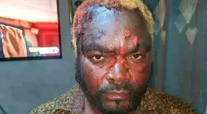 General Kanene hospitalised after machete attack at rally