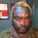 General Kanene hospitalised after machete attack at rally
